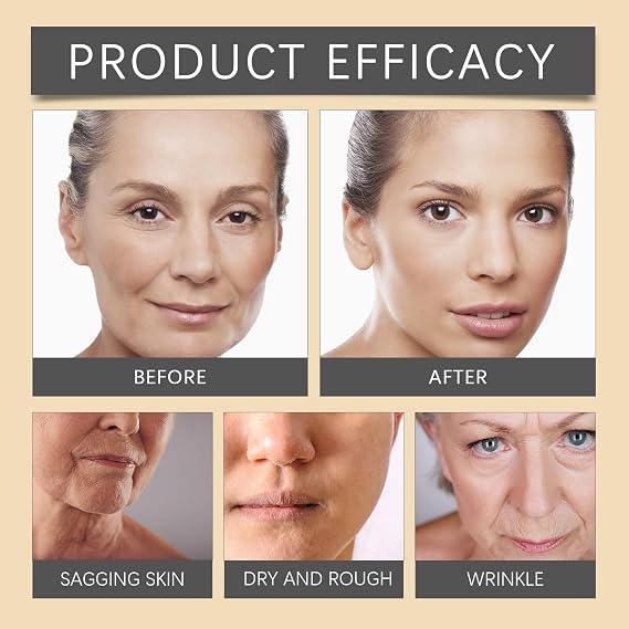 Bee Venom Wrinkle Removal Cream, Bee Venom Moisturiser Cream, Lifting and Firming Restore Elasticity, Instant anti-aging Face Cream Skin, Wrinkles and all Skin Types (2pcs)