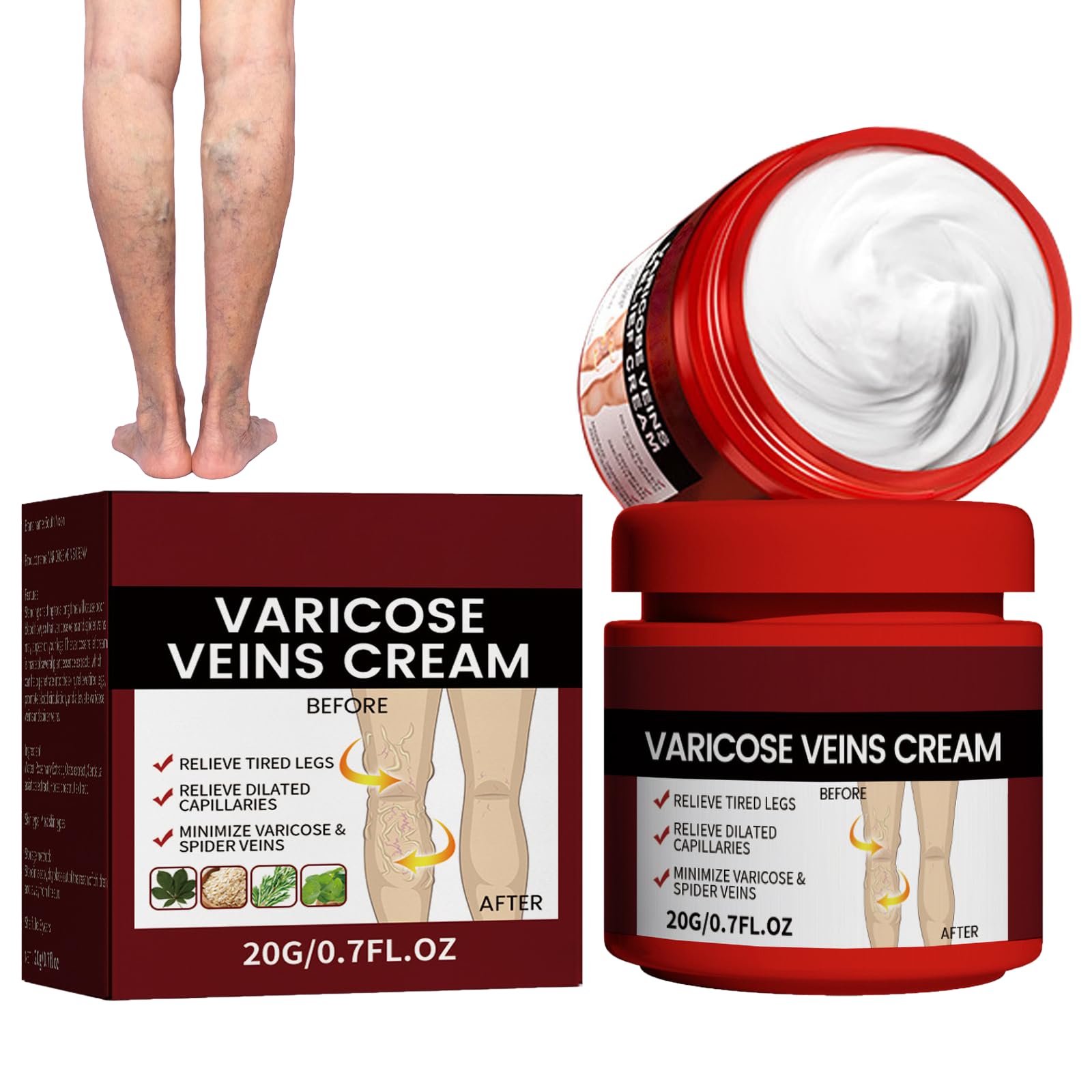 Varicose Veins Relief Cream, Spider Veins Repair Cream, Varicose Vein Remedies, Varicose Veins Treatment for Legs, Varicose Veins Cream