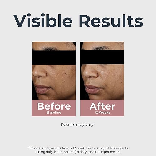 Miniatura 4 de Eucerin Crema nocturna de tono radiante, corrector de manchas oscuras con tiamidol, hidratante nocturno para cara ayuda a reducir visiblemente el