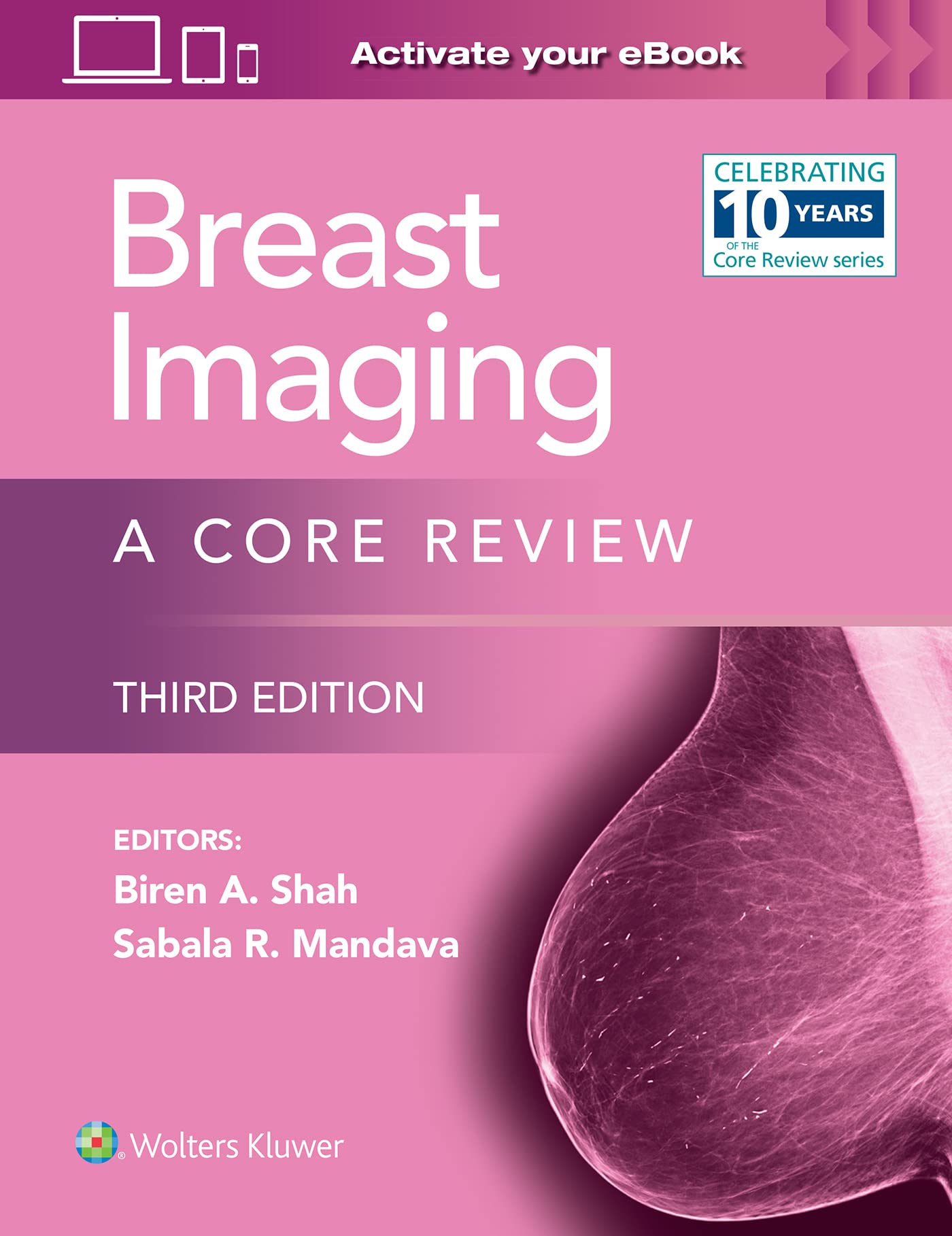 Diagnostic Breast Imaging 第2版 Breast Imaging: A Core Review: Print + eBook with Multimedia: Shah