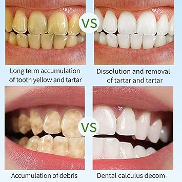 Deep Whitening Toothpaste,Toothpaste,Brightening White Toothpaste,Teeth Cleaning Toothpaste,Mint Toothpaste,Teeth Whitening Toothpaste Deep Clean,Fresh Breath (3PCS)