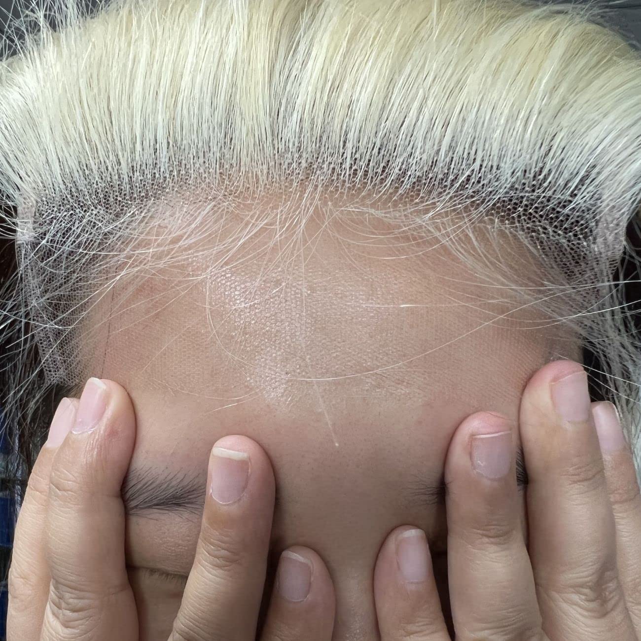 BEEOS 5x5 Skinlike Real HD Lace Closure Only, 613 Blonde 0.10mm Ultra-thin Invisible Swiss Lace Ultimate Human Hair Closure Pre-Plucked Natural