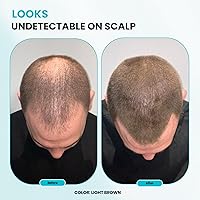 Vista 5 de SURETHIK Fibras capilares, 1.06 oz (marrón claro), cubre instantáneamente el cuero cabelludo y las áreas dispersas, acabado natural, adecuado