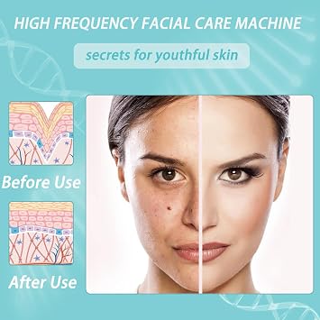 High Frequency Wand, High Frequency Facial Wand Stick 4-in-1 High Frequency Wand for Hair Growth Hair Frequency Wand Facial Toning Equipment, for Hair Regeneration, Anti-Aging, and Acne Treatment