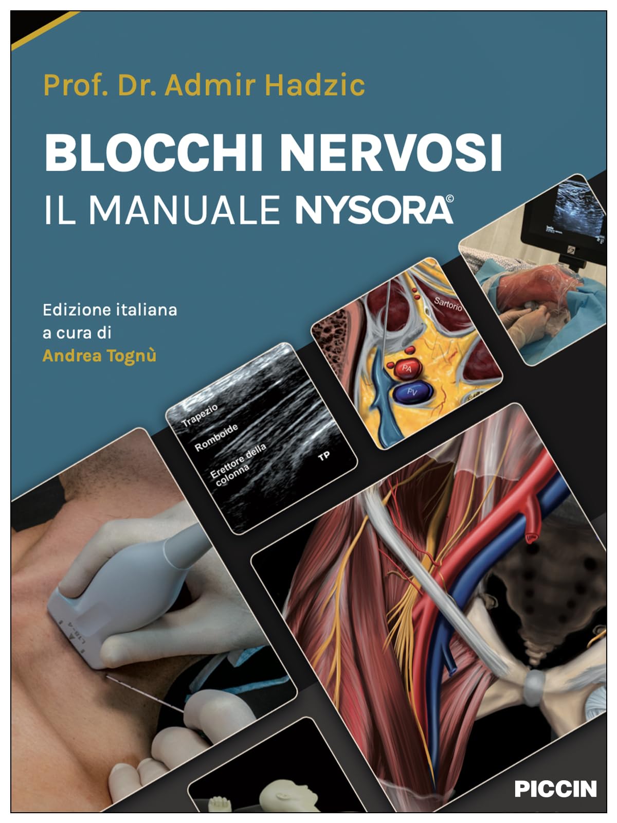 Blocchi nervosi. Il manuale nysora