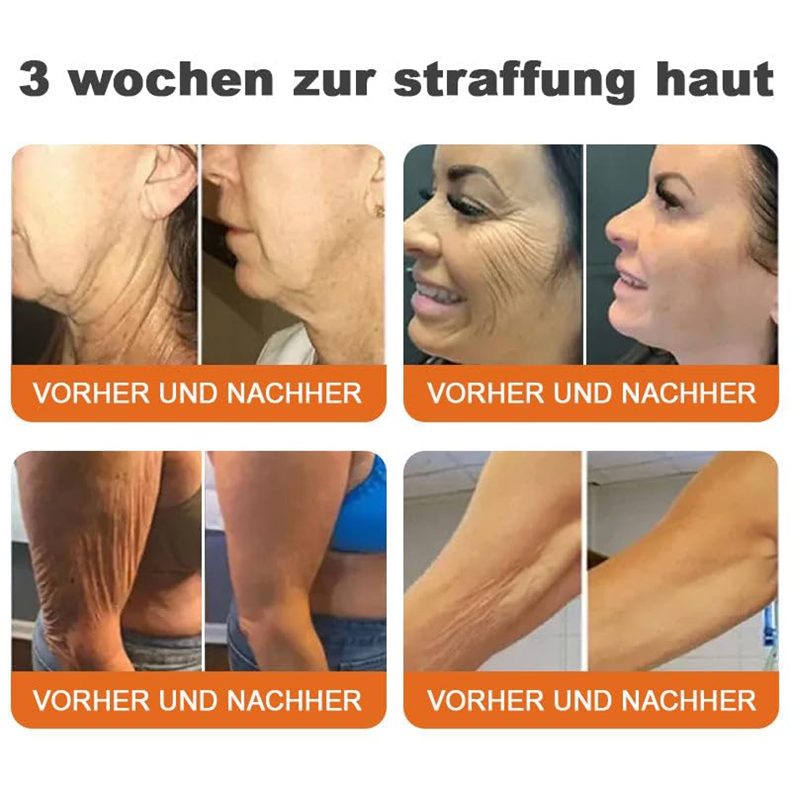 Spzv Bienengift StraffendeSerum Stick, Fortschrittliches Bienengift Straffende Creme Hautfeuchtigkeit, Spzv Bienengift Stick Sanfte Faltenentfernung für jeden Hauttyp (1)