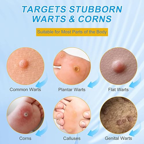Miniatura 3 de ZGjoib WART Almohadillas removedoras de maíz para pies, 40% ácido salicílico, almohadillas removedoras de maíz para dedos de los pies, cuerpo