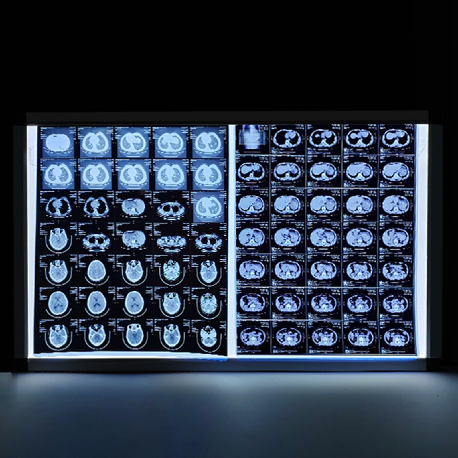 Caja De Luz LED Ultrafina for Radiografía, Visor Portátil De Película LED, Brillo Ajustable, for Clínicas y Hospitales(Small)