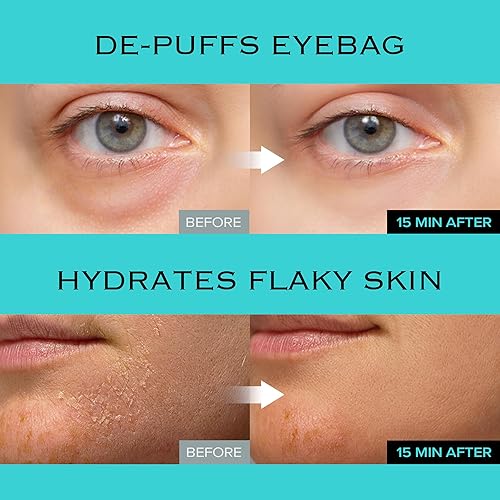 Miniatura 6 de Ice Sorbet Toner Pads  Toallitas de preparación de la piel para hinchazón, bolsas debajo de los ojos y estiramiento facial instantáneo, almohadillas