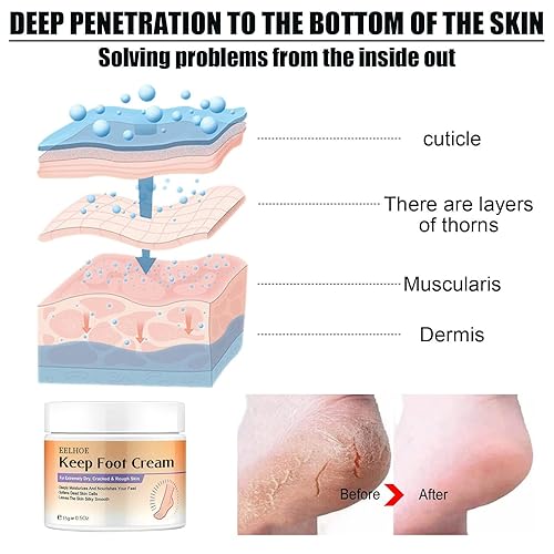 Miniatura 7 de Crema para pies  Crema reparadora de talones, aceite de caballo, crema de reparación de manos y pies, producto para el cuidado de la piel, removedor