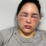 Customer Image, click to open customer review