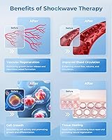 Vista 4 de Máquina avanzada de terapia de ondas de choque 2025, dispositivo de terapia de ondas de choque extracorpóreas para alivio del dolor, máquina ESWT