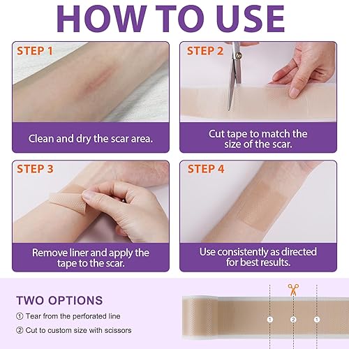 Miniatura 9 de Hojas de silicona para cicatrices, hojas de silicona para cicatrices, cinta de silicona para cicatrices quirúrgicas, cinta de cicatriz de grado
