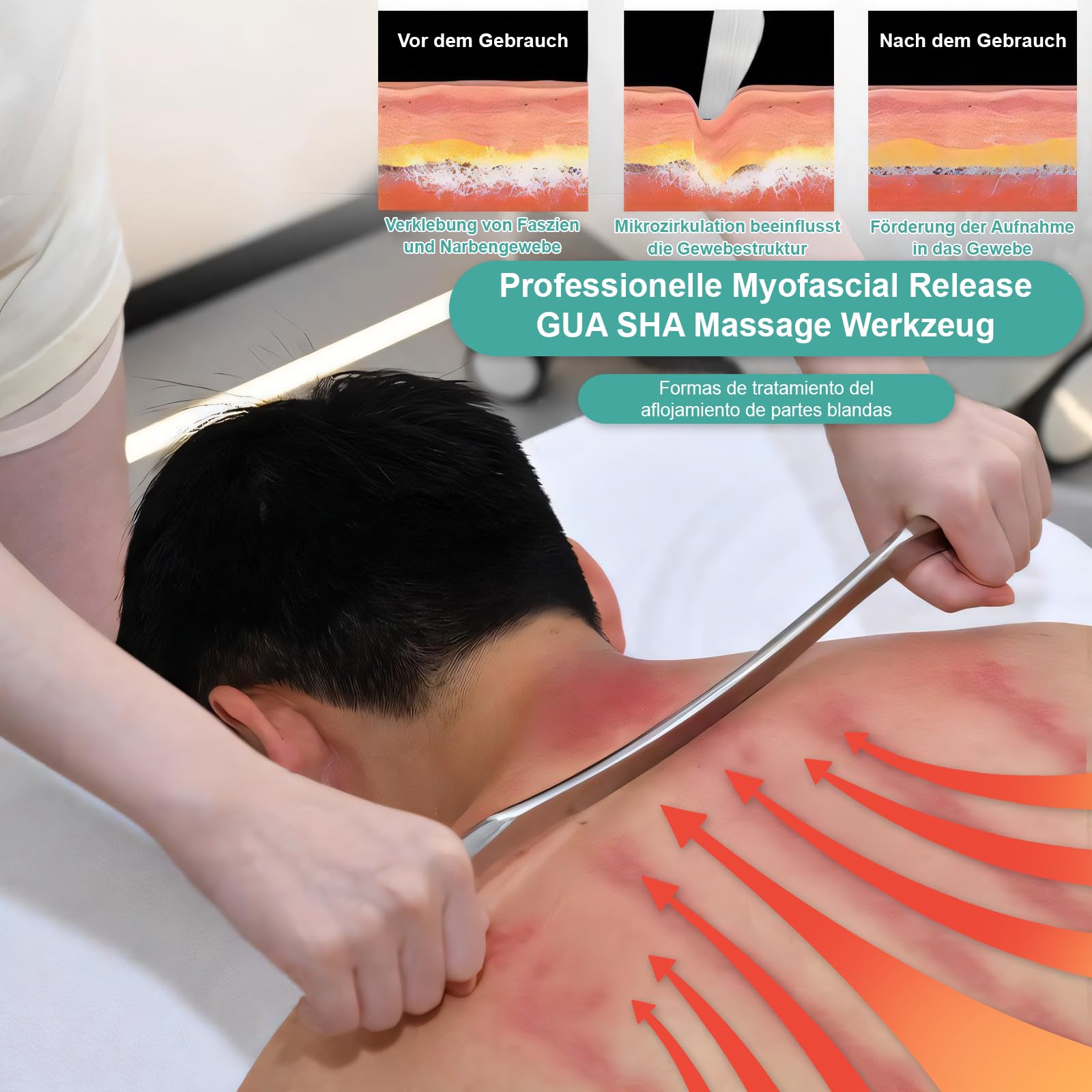 Gua Sha Grattoir en acier inoxydable pour muscles, fascia, outil IASTM pour détendre les tissus mous, améliorer les nœuds des fascias