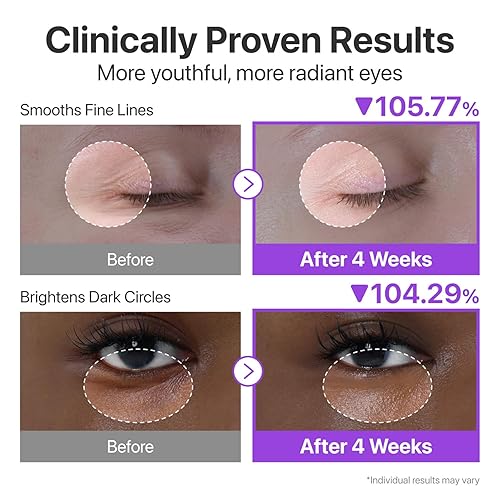 Miniatura 3 de numbuzin No.9 NAD+ Retinol Crema de ojos, Suero de ojos desinflamante y reafirmante para ojeras, arrugas y líneas finas, Péptidos y Niacinamida para