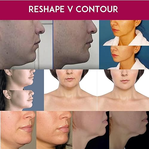 Miniatura 5 de Reductor de doble barbilla cuello suelto flacidez de la piel aprieta la cara reafirmante moldea antienvejecimiento Anacis Crema - 10fl oz