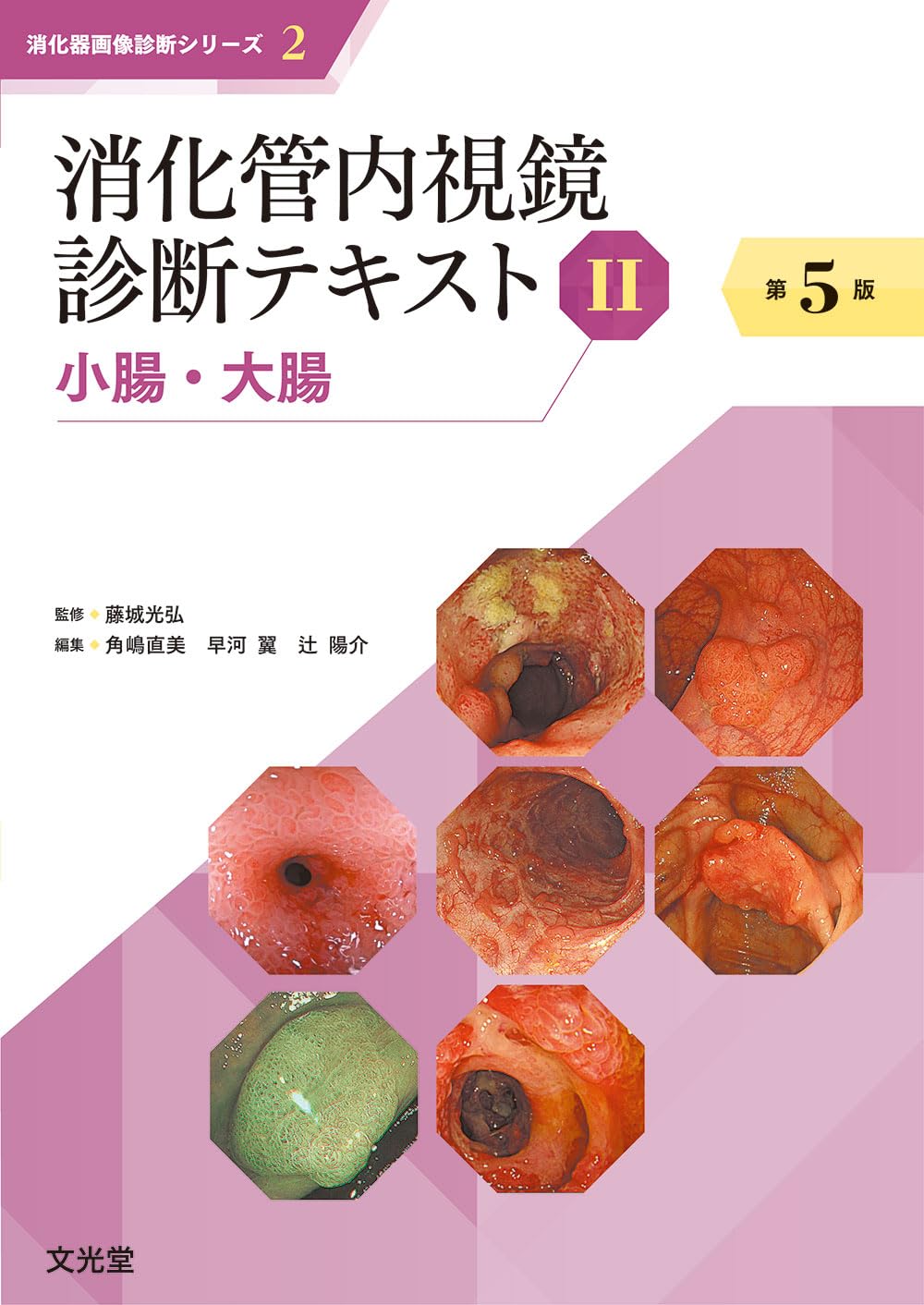 消化管内視鏡診断テキスト II 小腸・大腸 第5版 (消化器画像診断