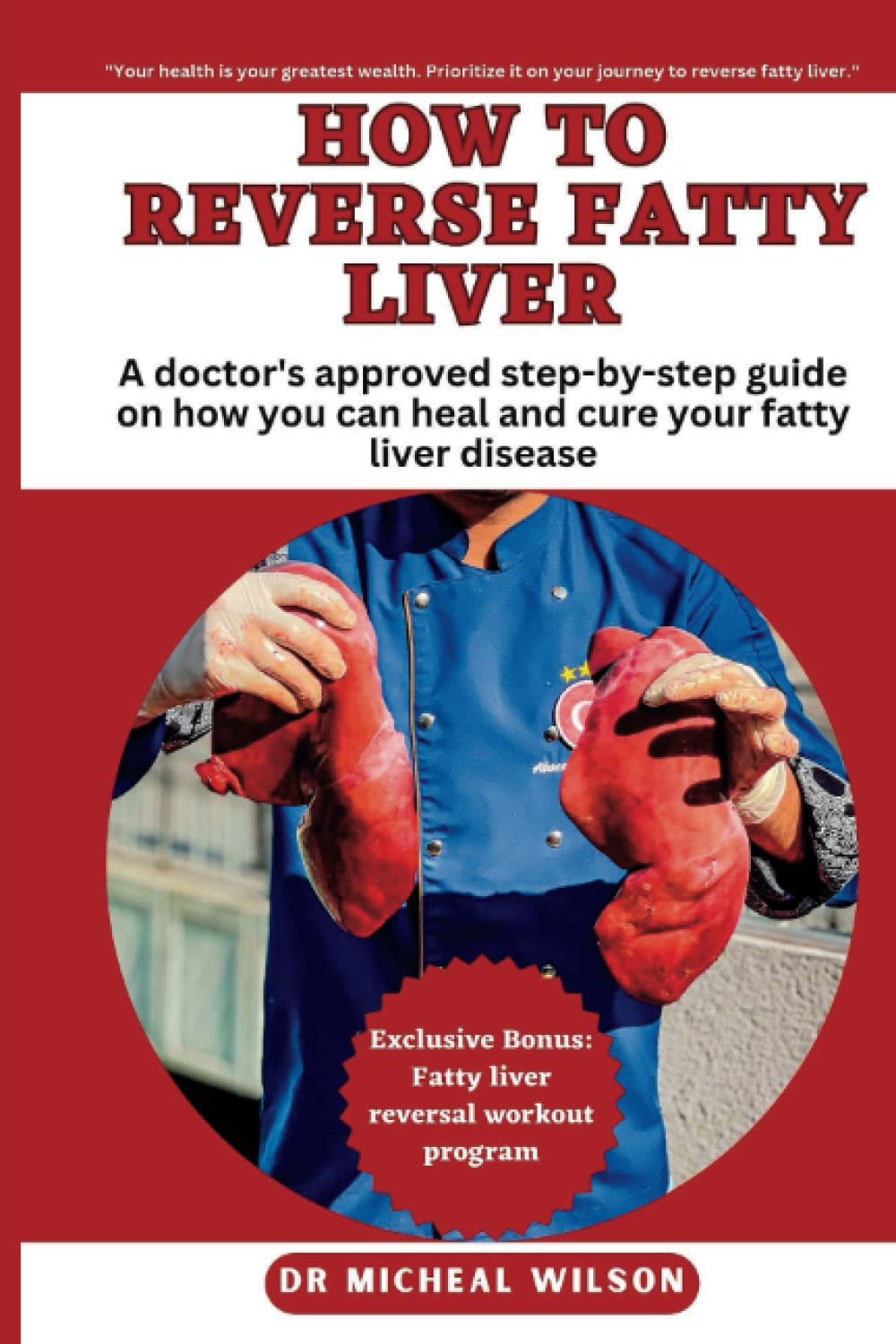 How to reverse fatty liver A doctor's approved stepbystep guide on