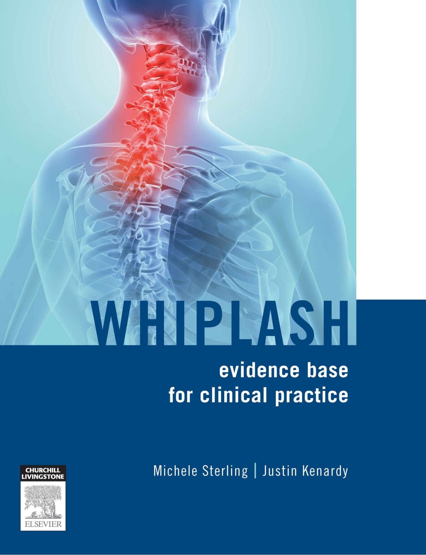 Buy Whiplash: evidence base for clinical practice — BookShops.in