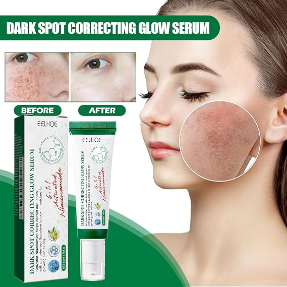 Face Serum - with Glycerin and Panthenol,Dark Spot Corrector & Hydrating Formula, Evens Skin Tone & Locks in Moisture for Radiant Glow,Improves Dullness & Uneven ToneMoisturizing Skin Care,1.76oz