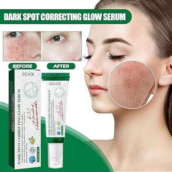 Face Serum - with Glycerin and Panthenol,Dark Spot Corrector & Hydrating Formula, Evens Skin Tone & Locks in Moisture for Radiant Glow,Improves Dullness & Uneven ToneMoisturizing Skin Care,1.76oz
