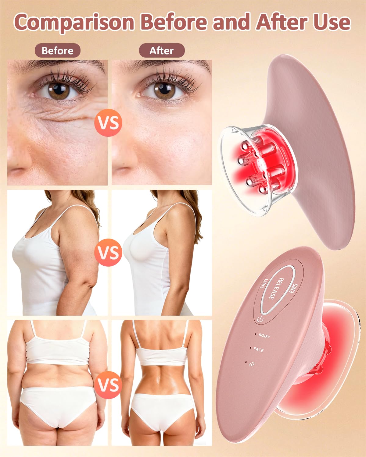 Massaggiatore per coppettazione, modellazione e tonificazione per favorire la circolazione sanguigna, aumentare l'elasticità della pelle, Yansoo 3 in 1, massaggiatore anticellulite, coppettatrice EMS