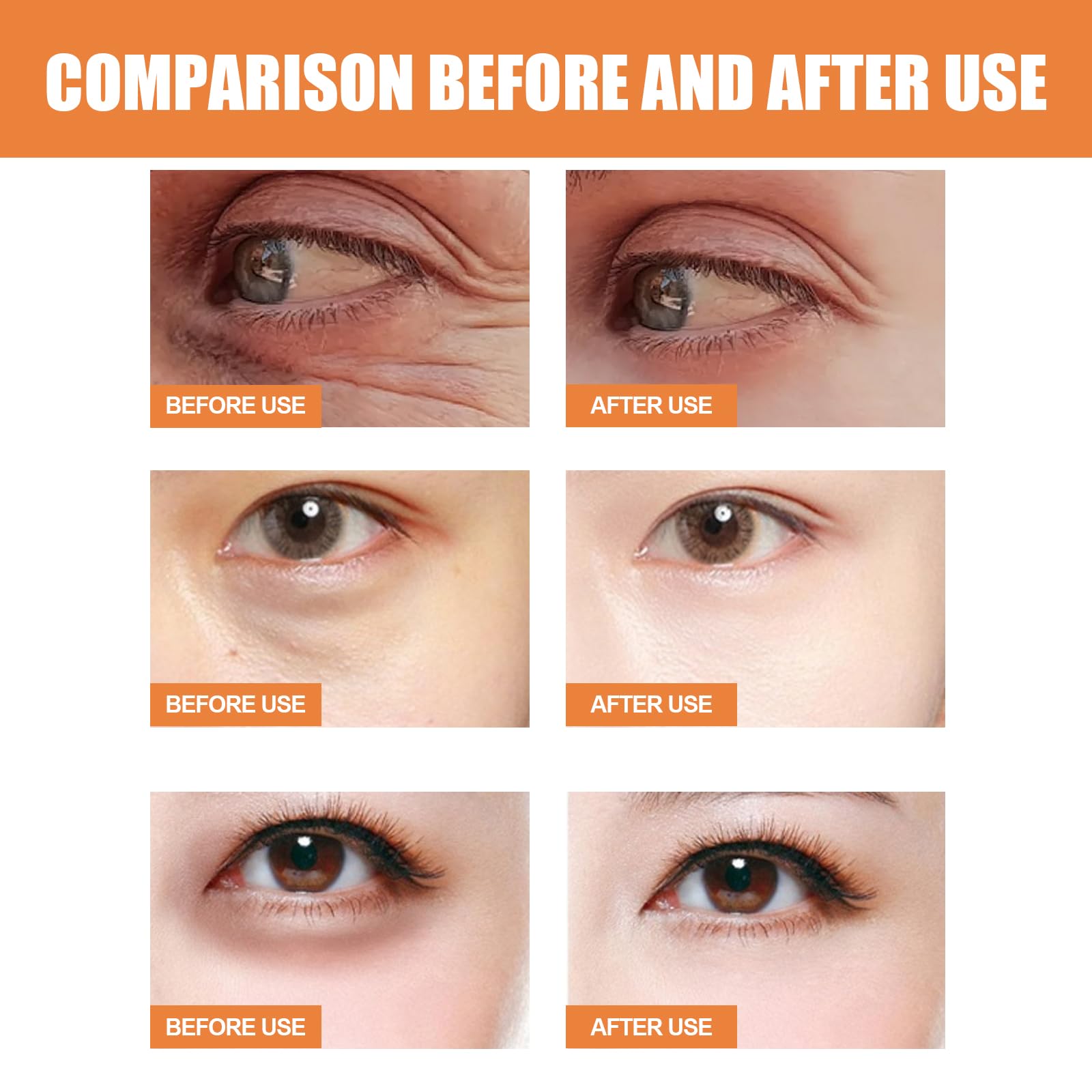 Baume pour les yeux à la vitamine C éclaircit et réduit les poches, Stick hydratant pour les yeux MultiCorrexion pour les cernes et les poches, Crème hydratante au rétinol Sérum rides profondes (1pcs)