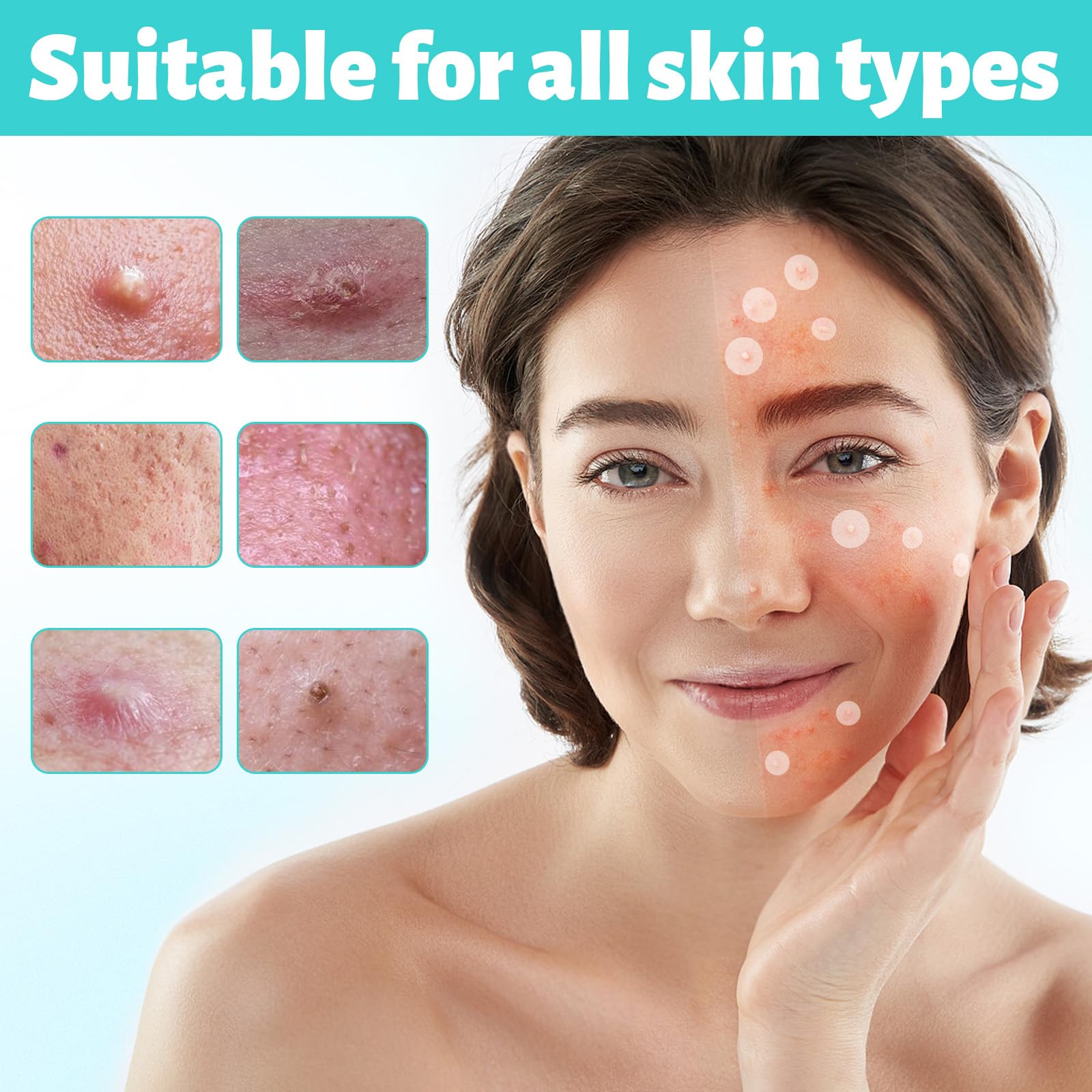 385 Pezzi Cerotti brufoli, Invisibili Cerotti Idrocolloidali, Con olio di Tea Tree e Centella Asiatica, Patch Brufoli Assorbenti Impermeabile e Traspirante, 2 In 1 Giorno e Notte Acne Patch