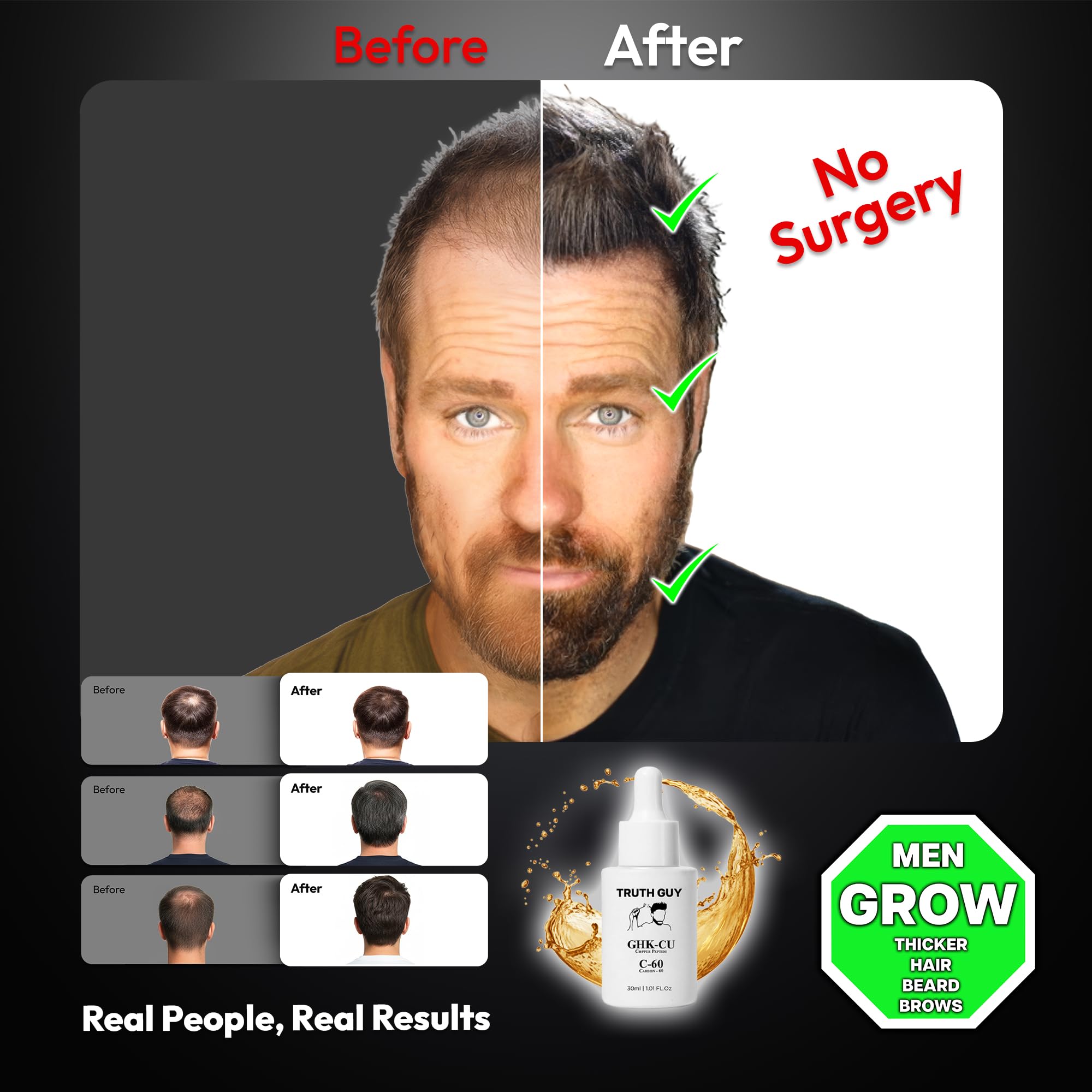 ghk-cu beard growth or facial hair Multi-Peptide Density Booster Serum 10ML For & 5% GHK-Cu for HAIR LOSS 