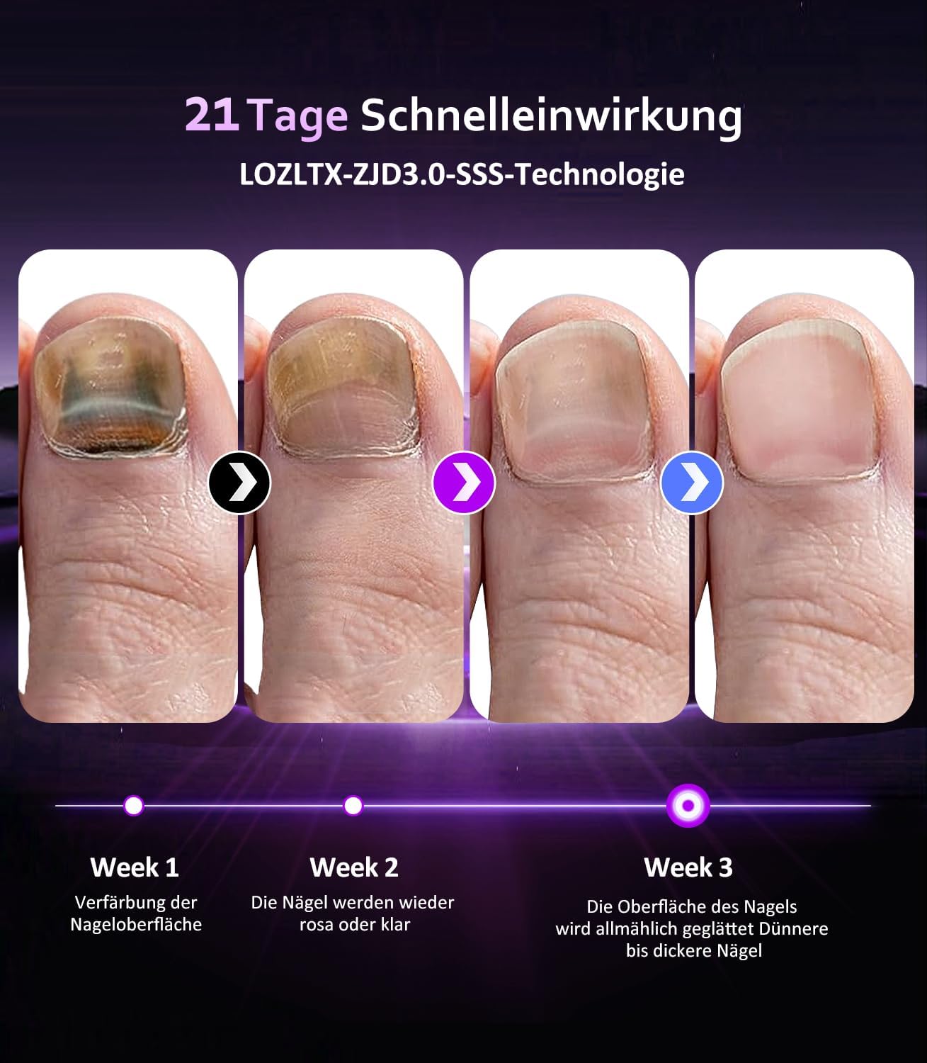 Nagelpilz Lasrgeät mit Zeitmessgerät 【3 Blau 1 Infrarot-Upgrade】Nagelpilz Laser【21Tage schnell wirkende】Laser NagelilzNaelpilz Testsieger