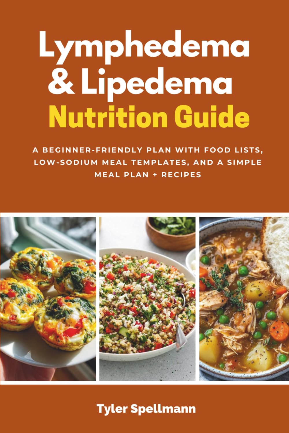 Lymphedema & Lipedema Nutrition Guide: A Beginner-Friendly Plan with Food Lists, Low-Sodium Meal Templates, and a Simple Meal Plan + Recipes