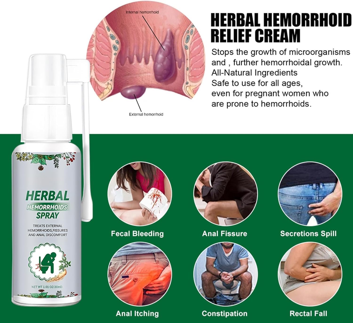 2PC Hémorroïdes Spray,Spray De Traitement Contre Les Hémorroïdes,Skin Therapy Cream, Réduit les Gonflements, Soulage la Douleur et l'inconfort, et Répare les Dommages