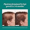 Nutrafol Women's Balance Suplementos para el Crecimiento del Cabello, Mayores de 45, Botella para 1 mes | Marca #1 recomendada por dermatólogos para el crecimiento del cabello, clínicamente probada para cabello visiblemente más grueso y cobertura del cuero cabelludo (Paquete de 1) 7