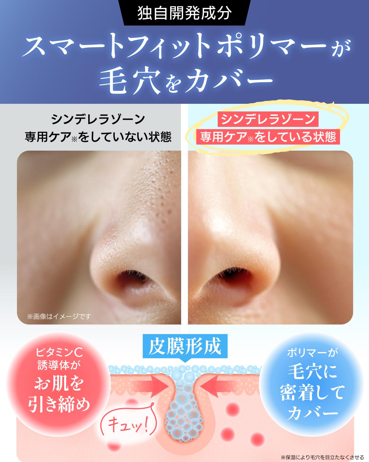 オールレチノCクリーム 純粋レチノール0.4%配合 キソ REクリーム 50g ビタミンA バクチ