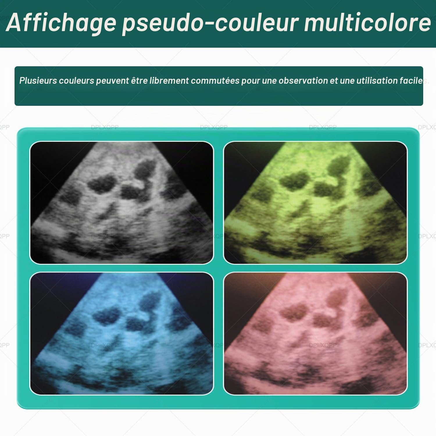 échographe Vétérinaire Portable,Appareil échographie avec Sondes (M1, M2, M3) pour Diagnostic De Gestation des Porcs,Bovins,Ovins,Chevaux,Chiens & Chats,écran LED 5.6" M3