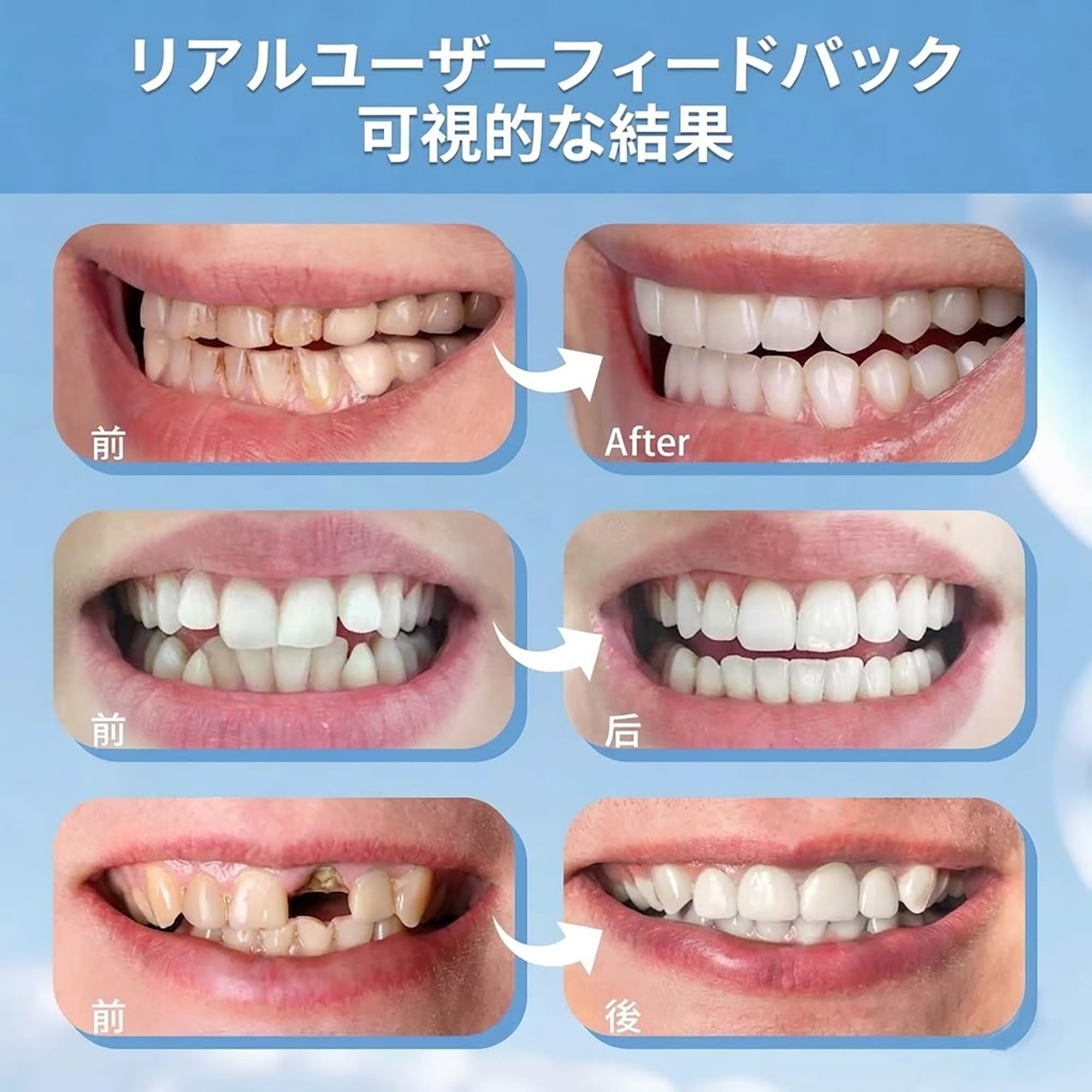 化粧用義歯 ２組 Amazon.co.jp: 【2ペアセット】仮歯 付け歯 自分で作る 多機能 臨時