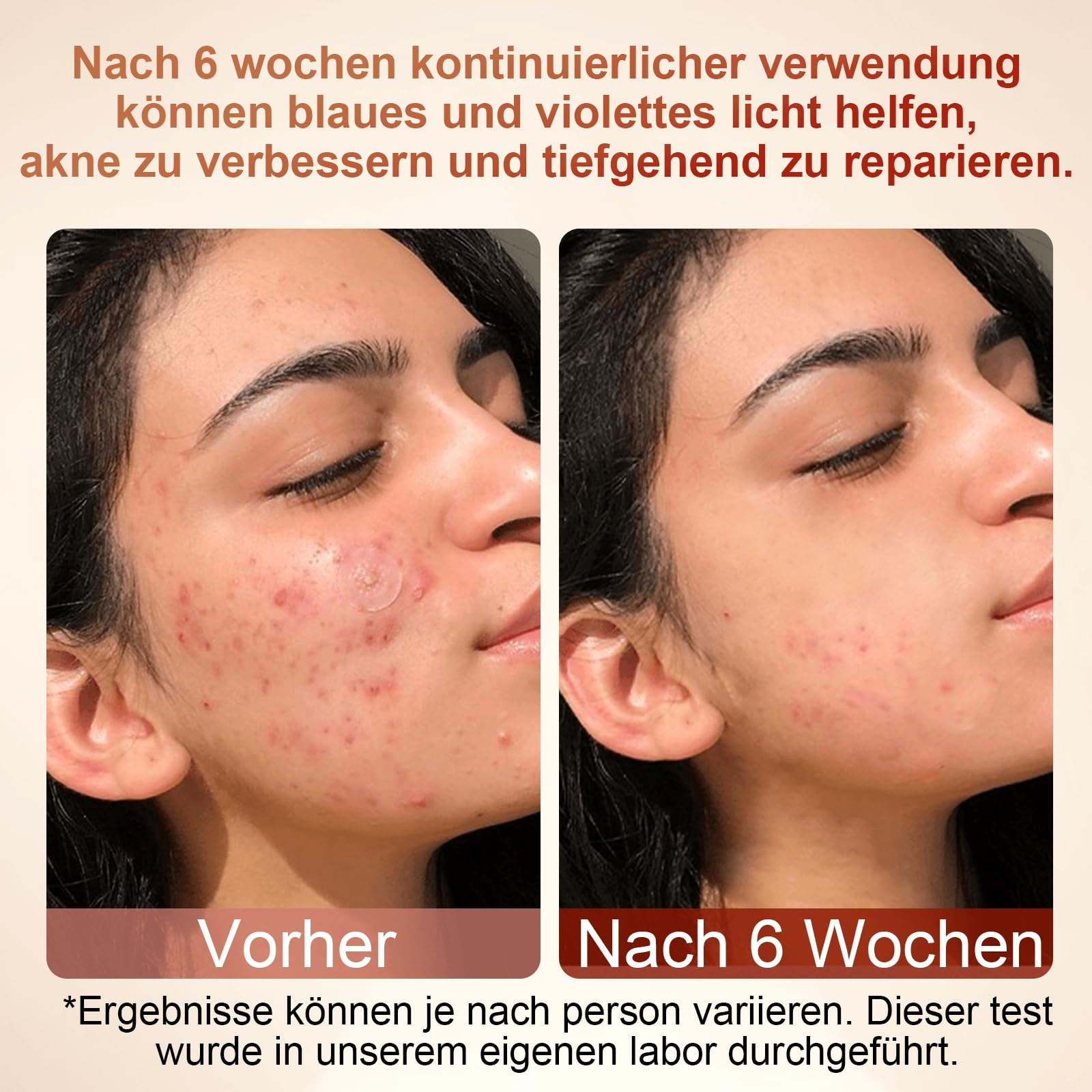 LED Maske Gesicht 4 Farben 64 Rotlichtlampe Gesichtsmaske Kabellose