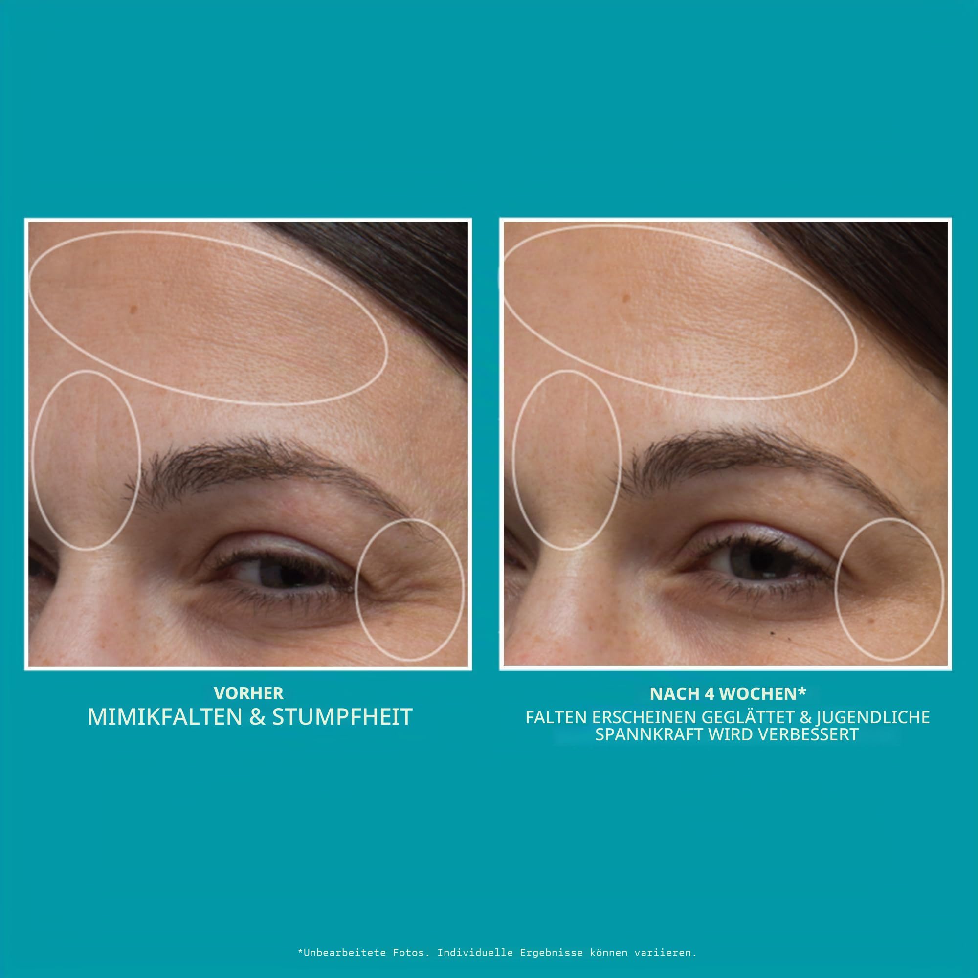 Peter Thomas Roth - Peptide Skinjection™ Feuchtigkeitscreme Nachfüllbar – Anti-Aging Gesichtscreme mit Peptiden, Intensive Hydratation & Straffende Pflege