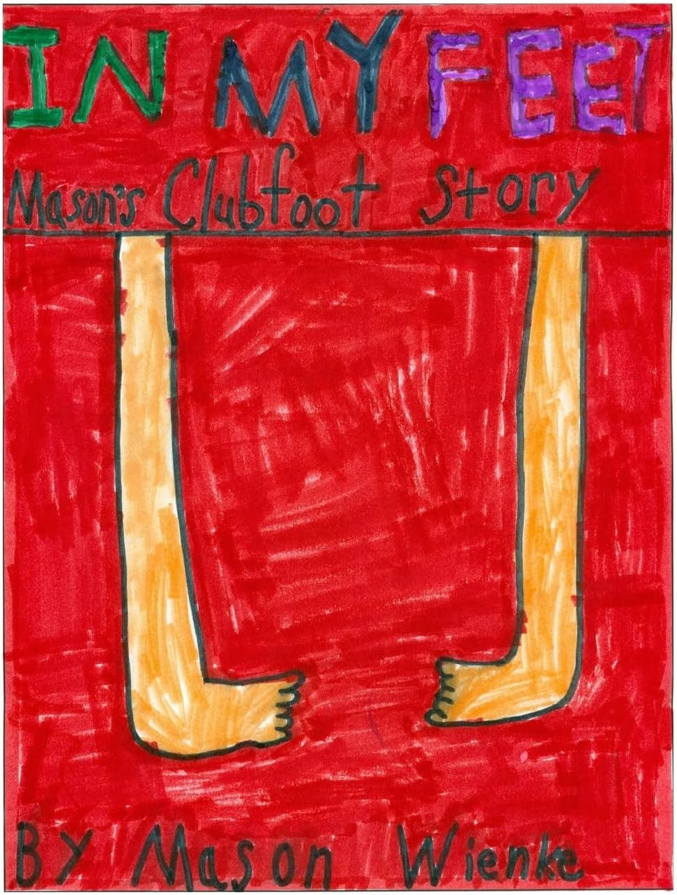In My Feet: Mason's Clubfoot Story