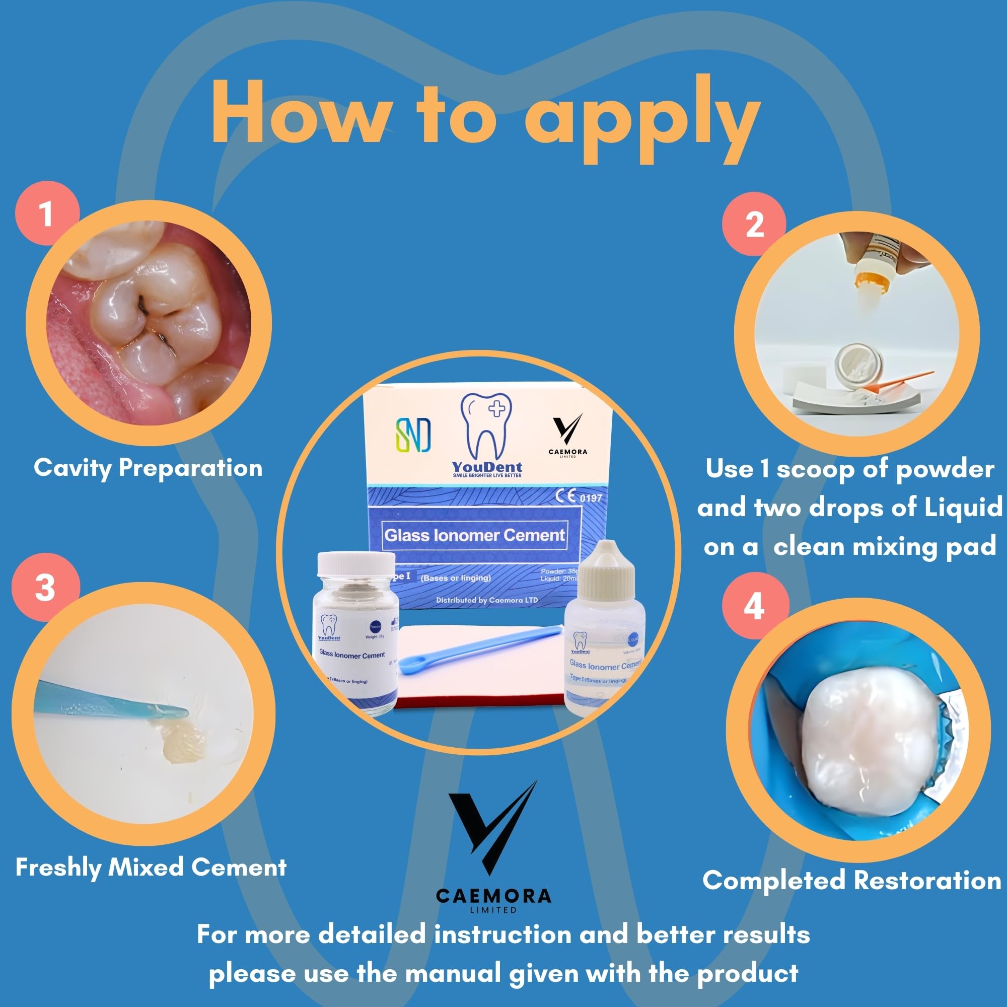 Caemora Kit de reparación dental Cemento dental de ionómero de vidrio Relleno permanente