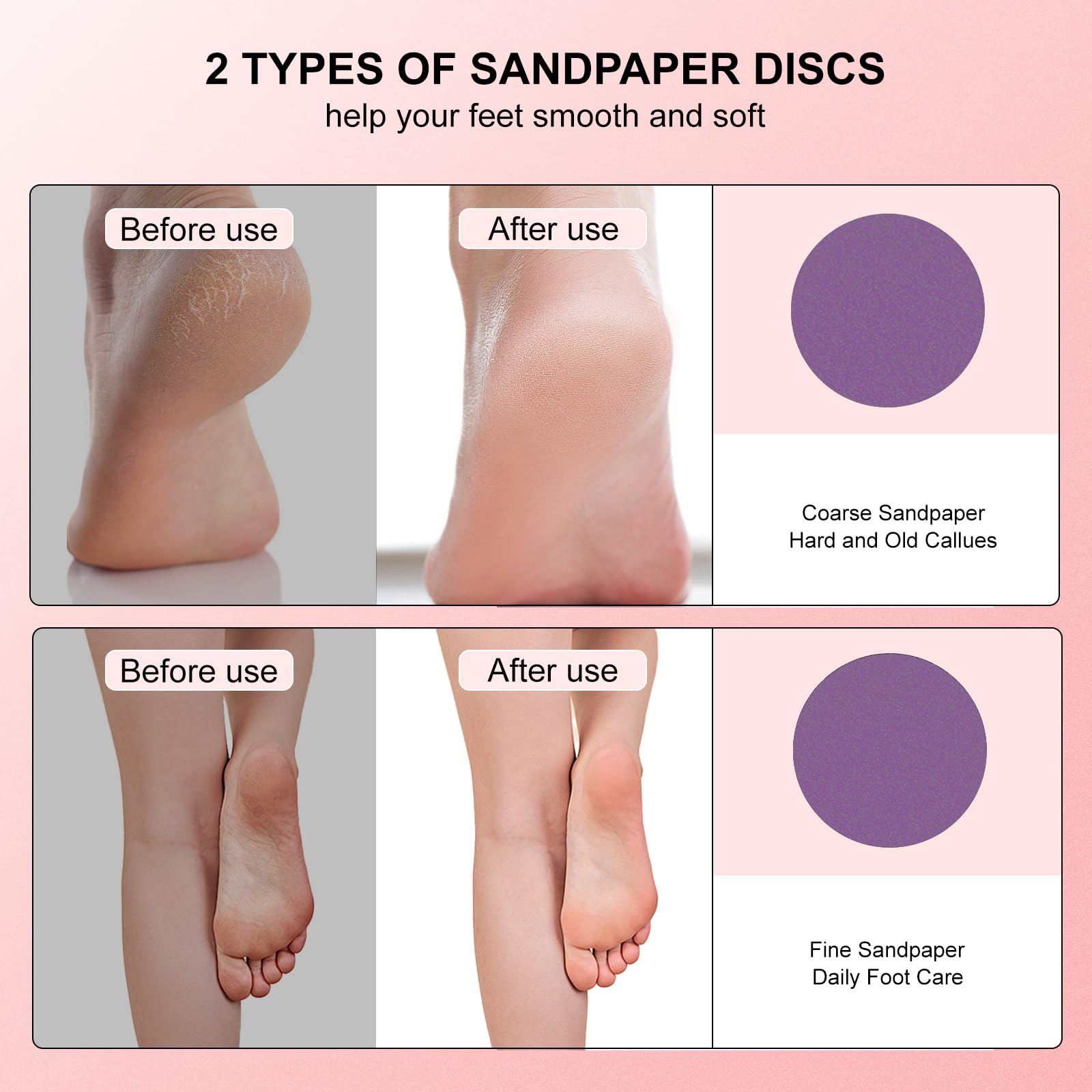 Electric Waterproof Foot File Callus Remover