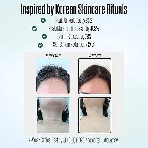 Miniatura 3 de POSEION BT100 DG - Cabezal de ducha filtrado de mano, alta presión, filtro de sedimentos magnetizado, corriente de agua ultrafina, comodidad similar