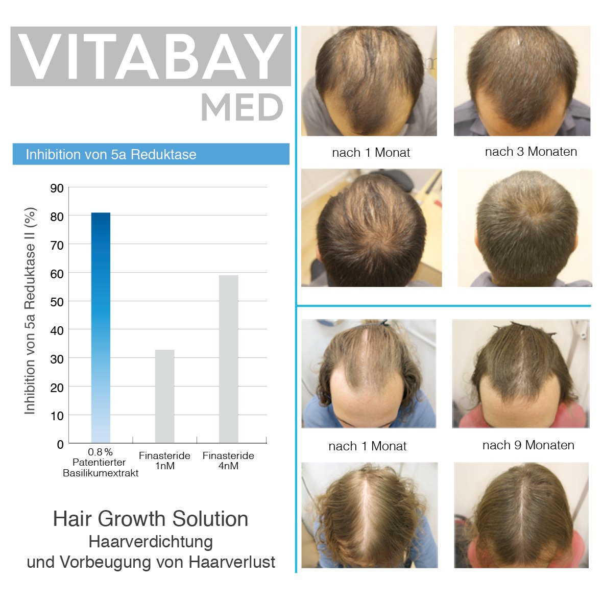Vitabay Hair Growth Solution 70 ml • Siero contro la Perdita dei Capelli | Ispessimento e Crescita dei Capelli • Anticaduta Capelli Uomo e Donna