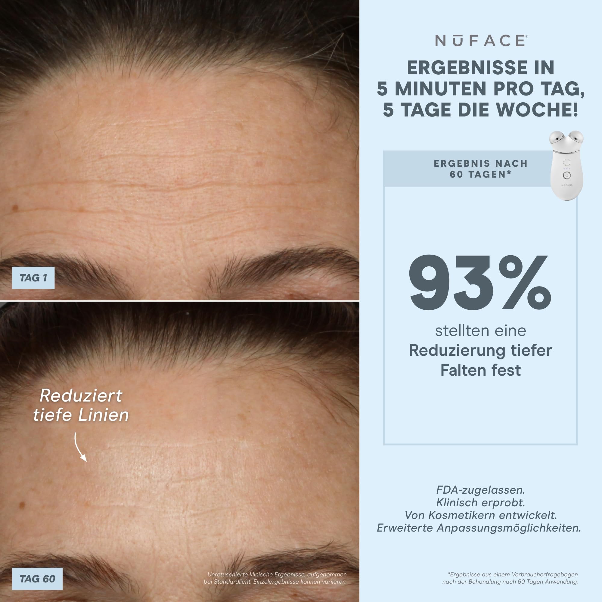 NuFACE TRINITY+ Lip & Eye Attachment