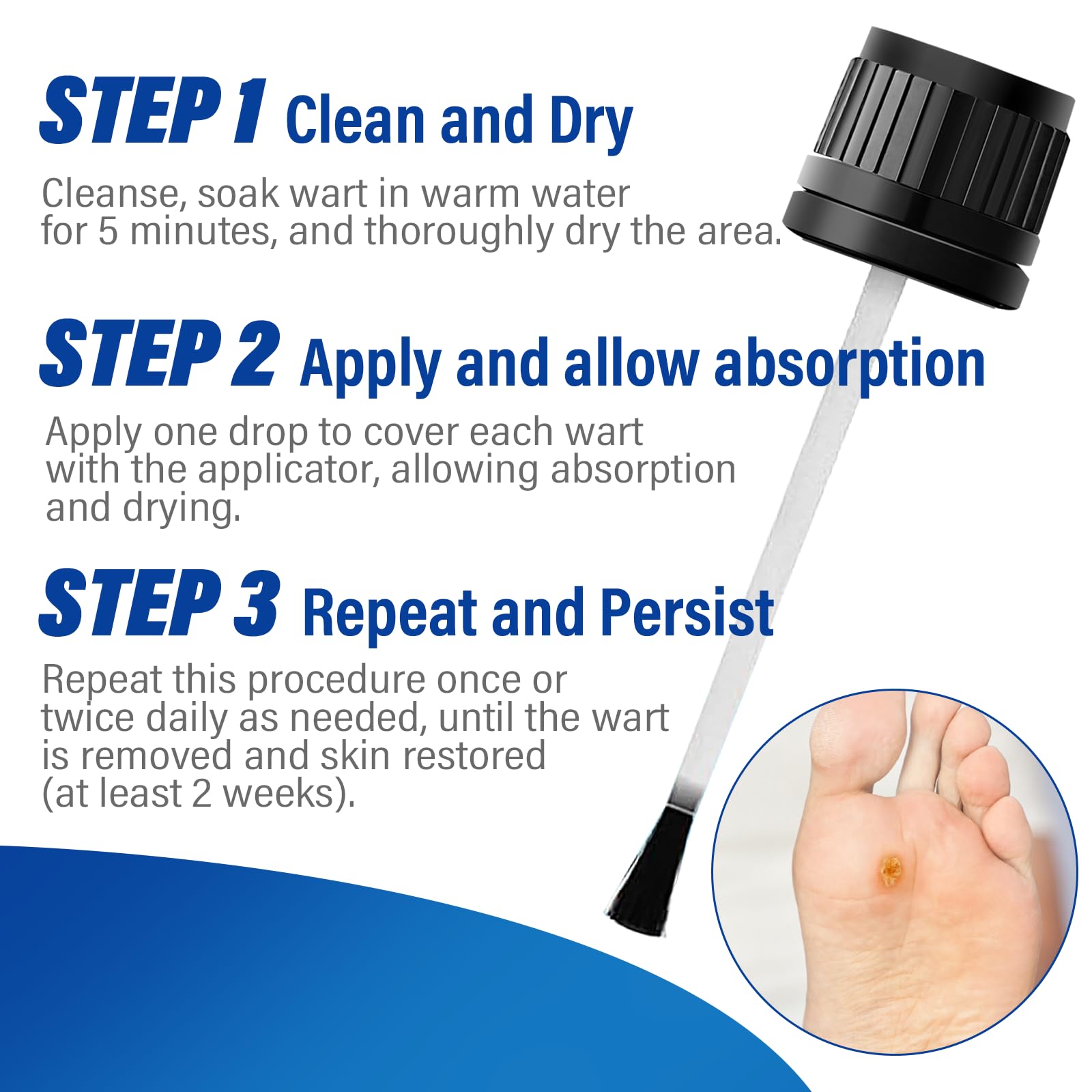 Extra Strength Wart Remover Liquid with 17% Salicylic Acid, Fast Acting Treatment for Plantar & Common Warts, Corn Remover for Feet and Toes, 15ml - 4