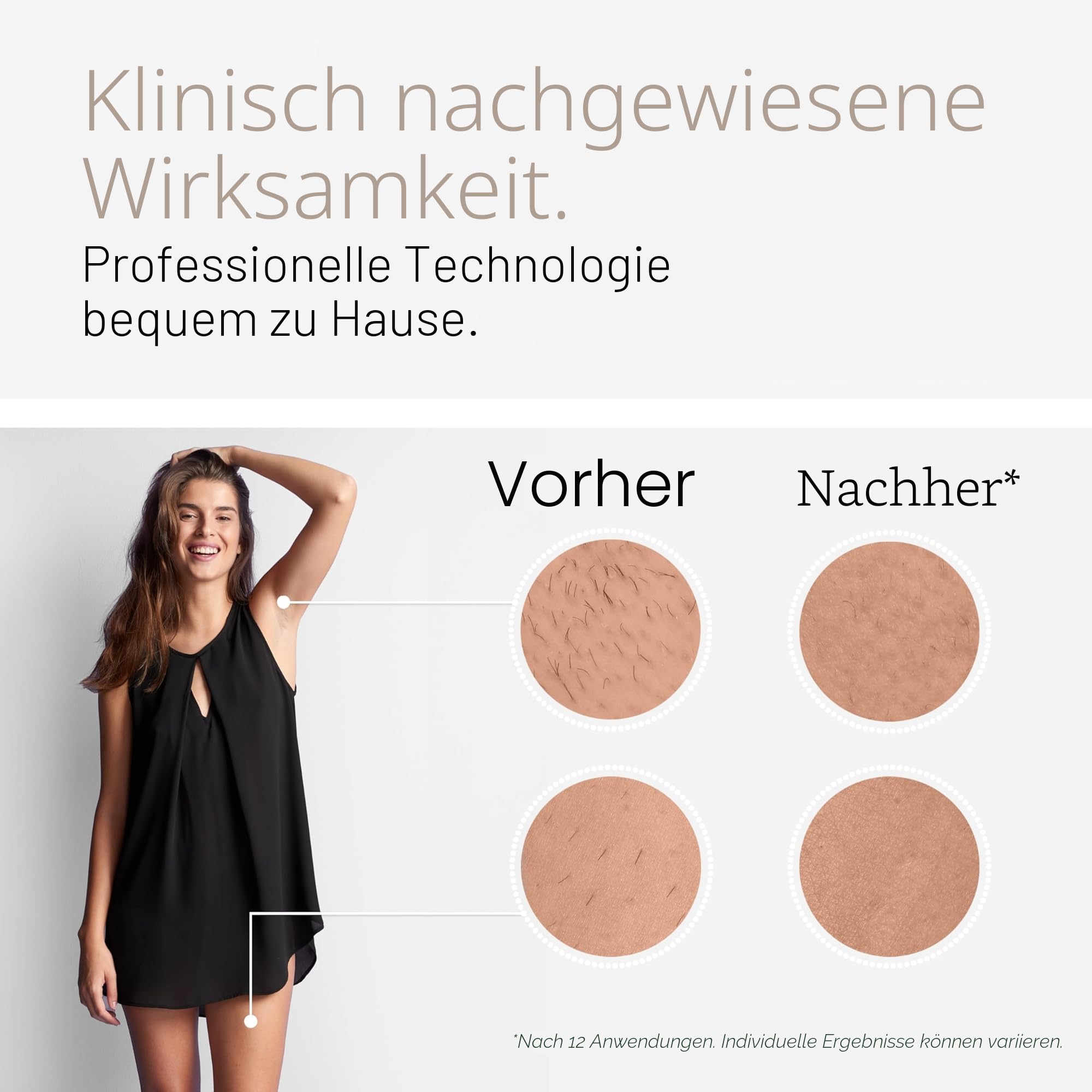 Braun IPL Silk-Expert Pro 5 PL5242 Haarentfernung für Zuhause, Weiß/Gold, mit Venus-Rasiersystem, 3 Köpfe