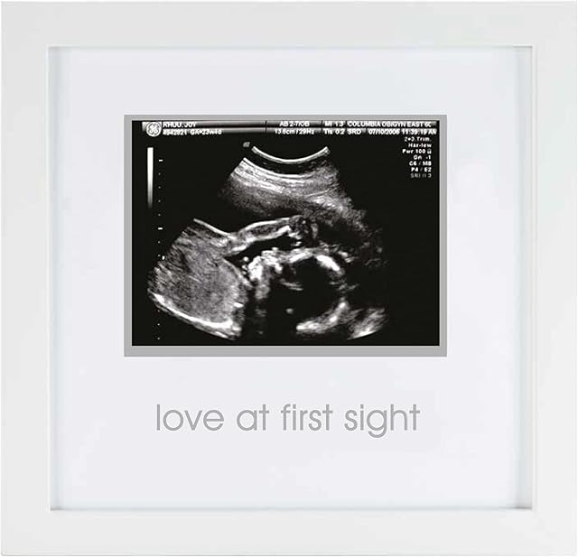 Pearhead Love at First Sight Sonogram Picture Frame, Baby Ultrasound Photo Frame, Baby Nursery Décor, Gift For New and Expecting Parents, White