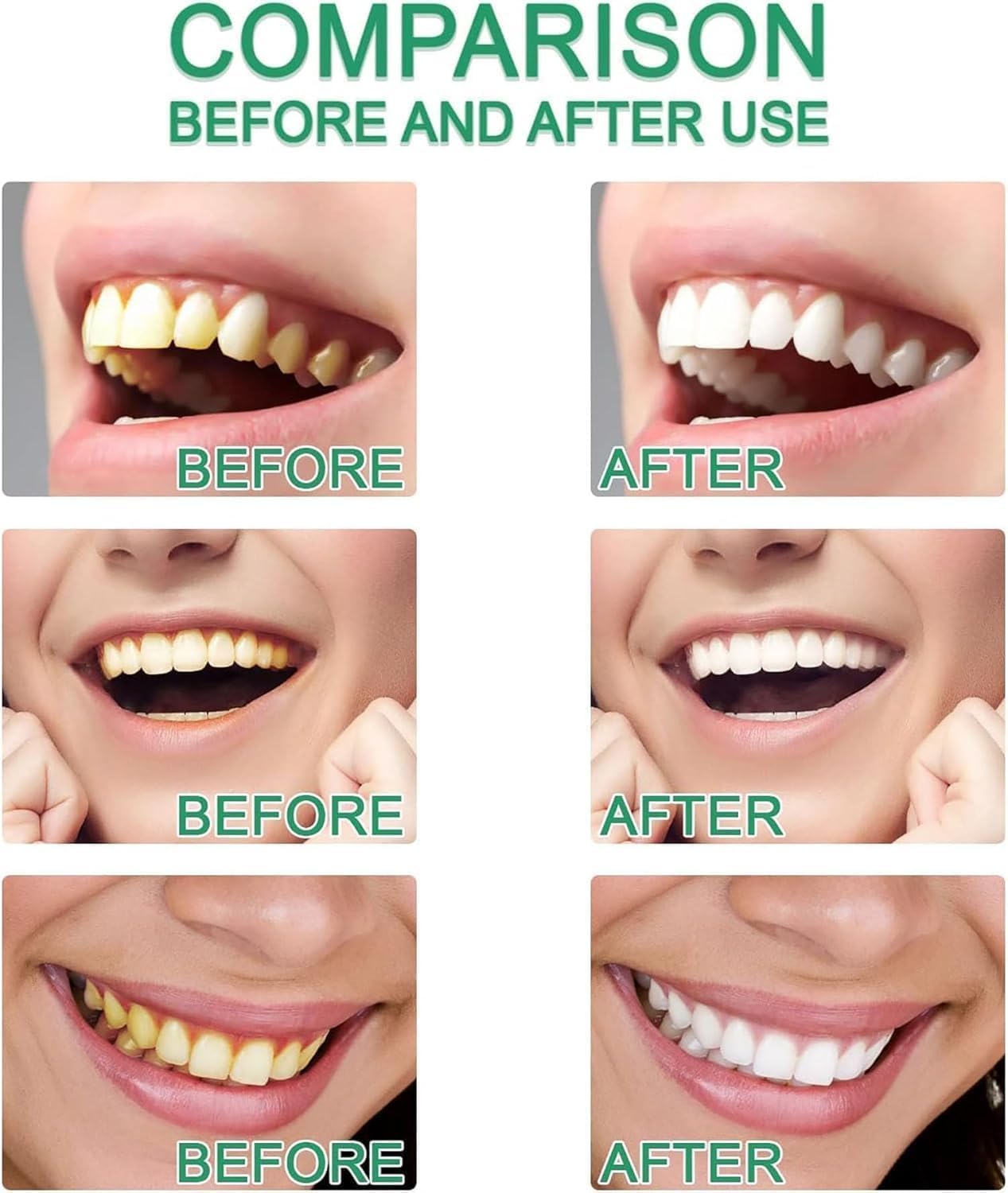 Easilyous Bright White Toothpaste, Strictrigid Niacinamide Whitening Toothpaste Bright White, Fresh Breath Toothpastes Remove Tooth Stains (2PCS)