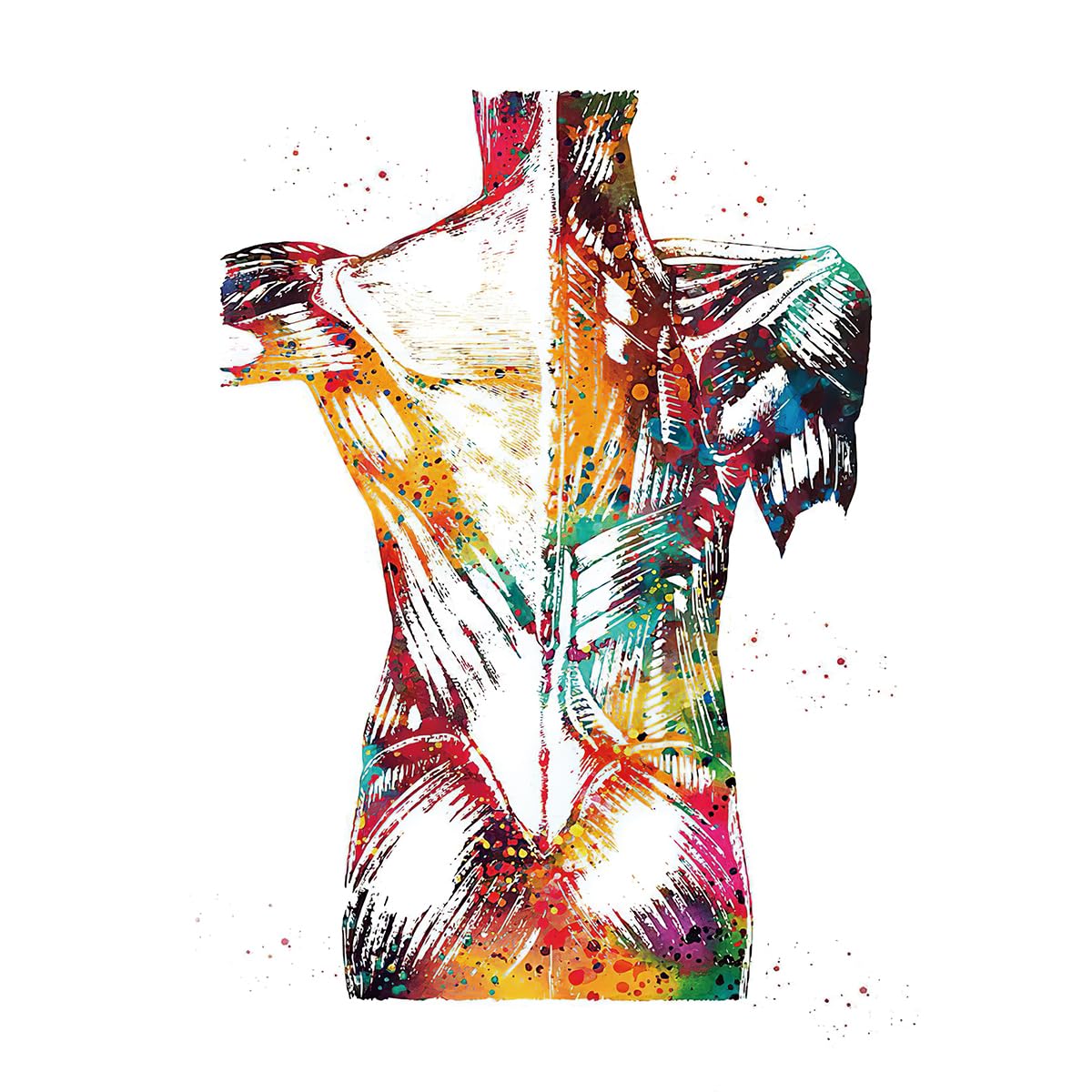 Anatomie Poster Hersenbloeding, gelamineerd