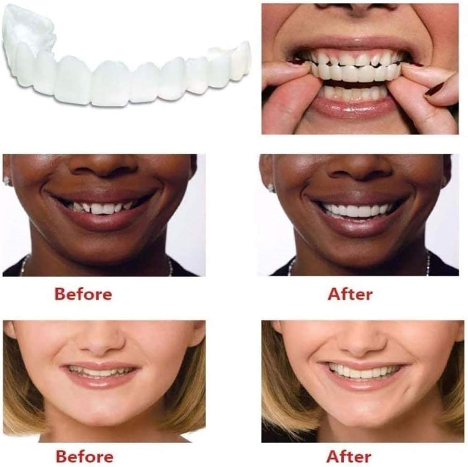 2 Pairs Temporary Cosmetic, Unisex Snap On Smile, Natural Comfortable Fit for Confident Beautiful Smile,Whitening Kits (White)
